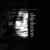 Uncovering Your Tracks - The Pineapple Thief